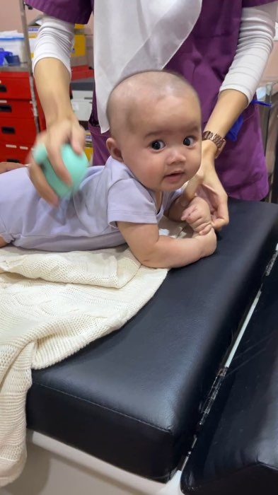 Pergi klinik pun doctor suruh guna suction cup ni nak longgarkan kahak anak #kahak #suctioncup